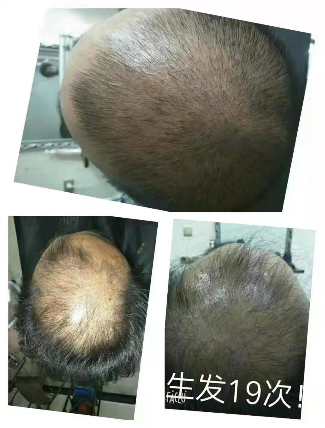 秀丝顿植物养发连锁加盟