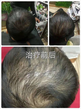 秀丝顿植物养发馆