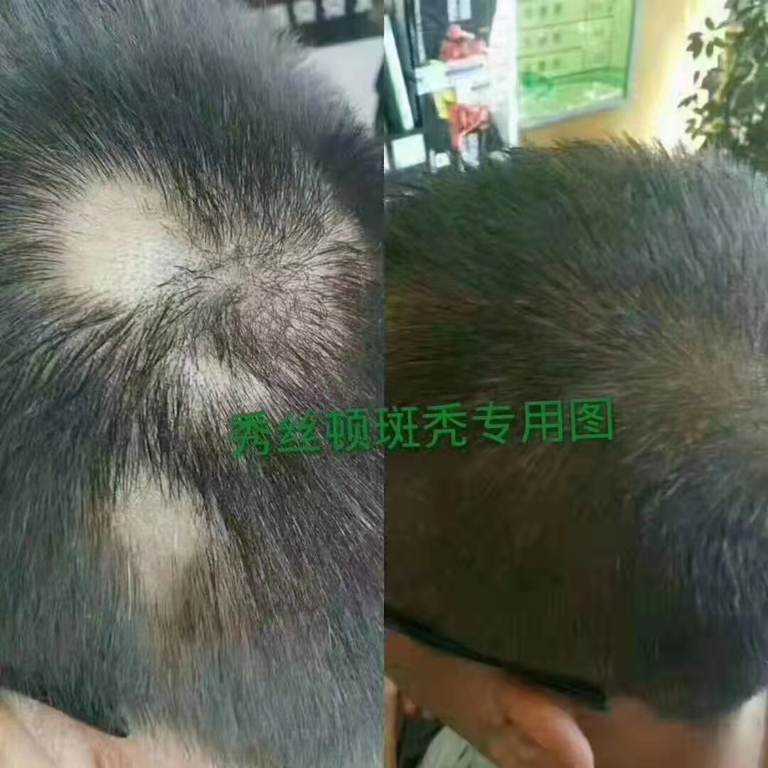 秀丝顿植物养发馆是润奇公司旗下的一个全国连锁加盟的专业植物养发馆