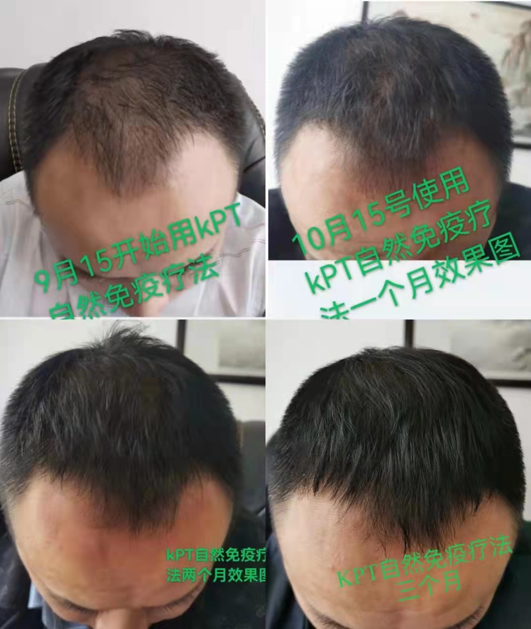 秀丝顿植物养发健康采用纯天然的植物成分，不含硅油、矿物油等化学成分