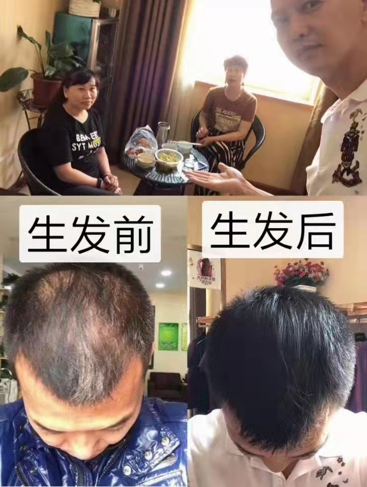秀丝顿头疗养发馆经过10多年发展已经加盟1000多家店面