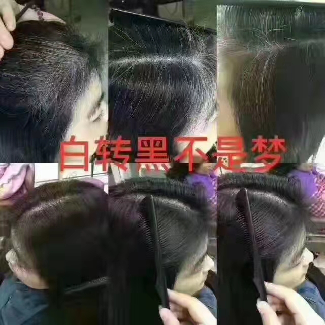 秀丝顿植物养发，让你轻松实现白发养黑，再也不用为秀发问题而烦恼！