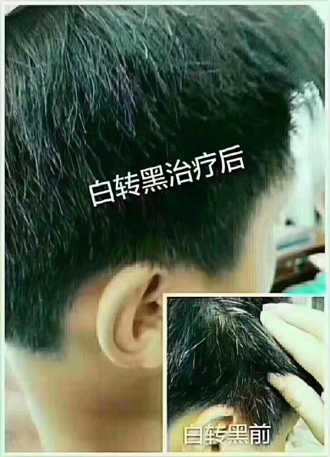 秀丝顿植物养发，不仅能够滋养头皮，促进头发生长，还能够有效地将白发养黑