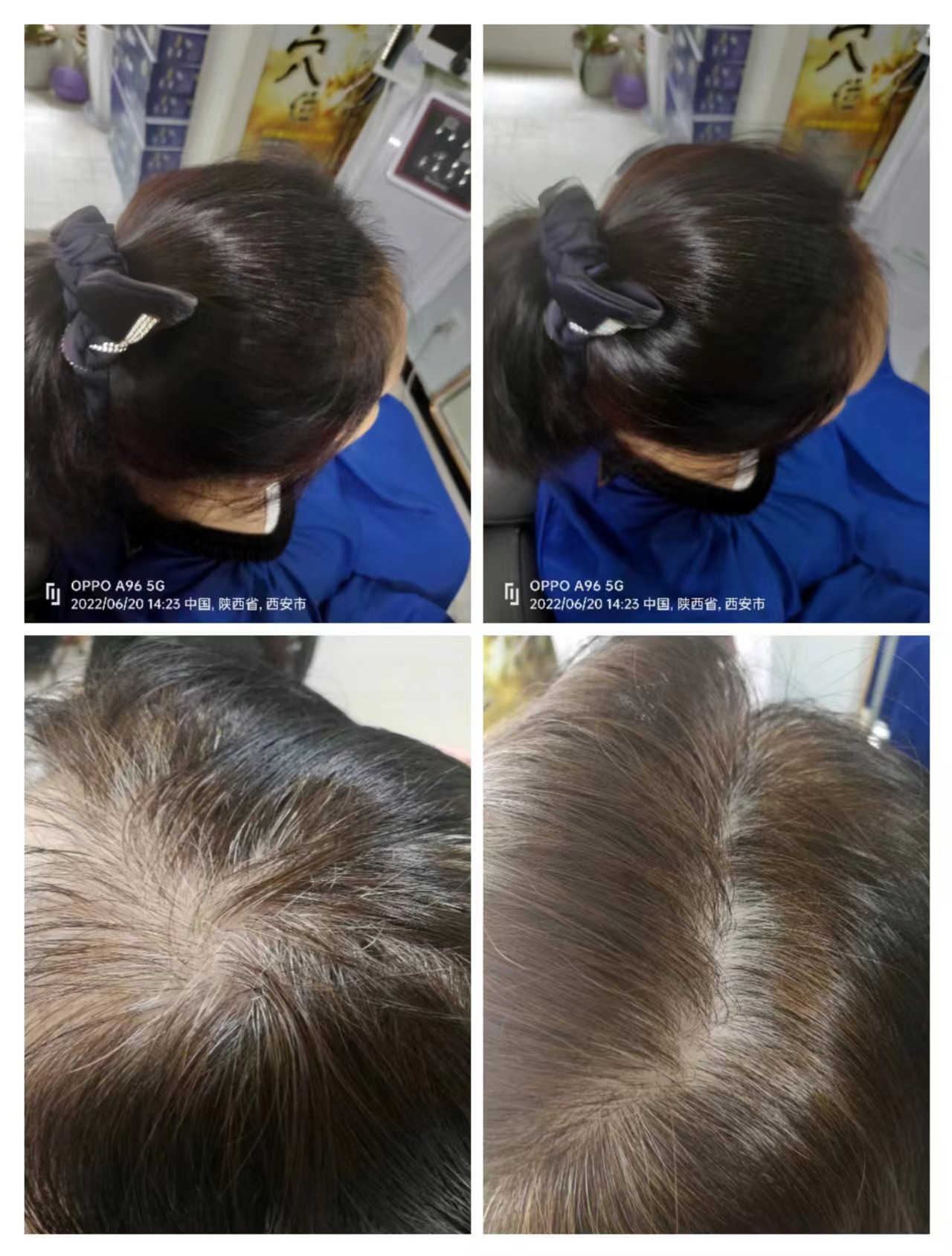 秀丝顿防脱发产品采用中药配方，不含任何化学添加剂