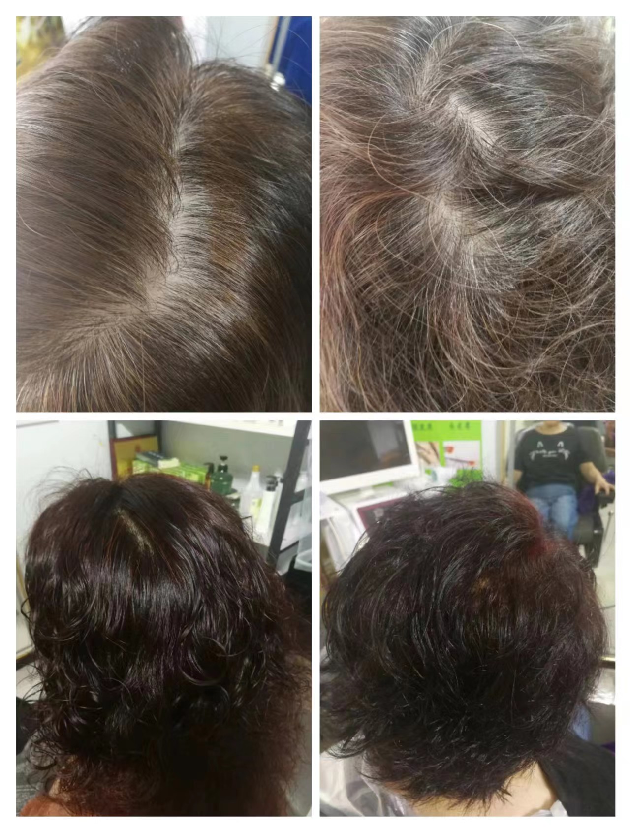 秀丝顿植物养发，不仅能够滋养头皮，促进头发生长，还能够有效地将白发养黑