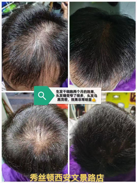秀丝顿植物祛头油采用了天然植物提取物，不含硅油、矿物油等化学成分
